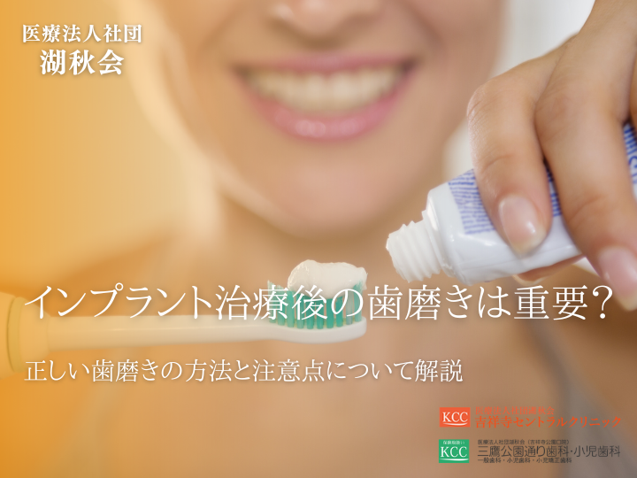 インプラント治療後の歯磨きは重要？正しい歯磨きの方法と注意点について解説