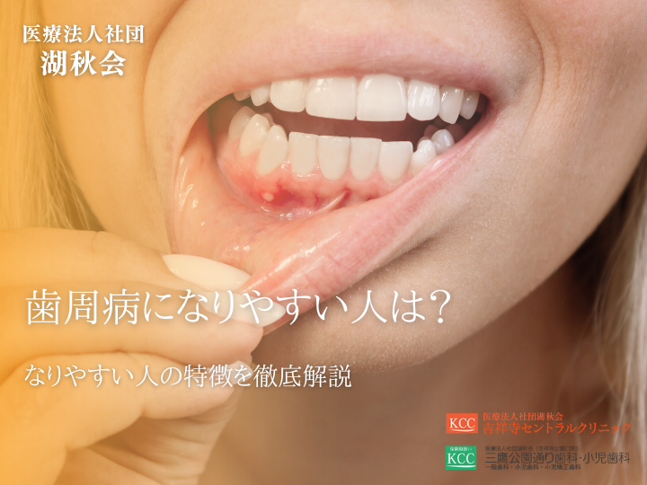 歯周病になりやすい人は？なりやすい人の特徴を徹底解説