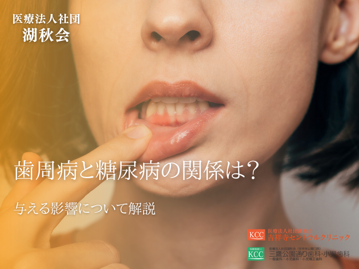 歯周病と糖尿病の関係は？与える影響について解説