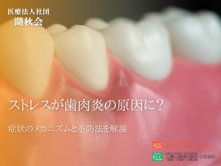 ストレスが歯肉炎の原因に？症状のメカニズムと予防法を解説