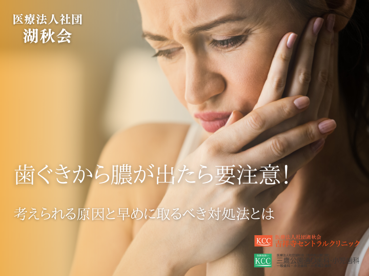 歯ぐきから膿が出たら要注意！考えられる原因と早めに取るべき対処法とは