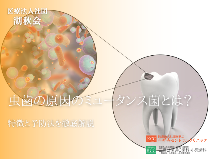虫歯の原因のミュータンス菌とは？特徴と予防法を徹底解説