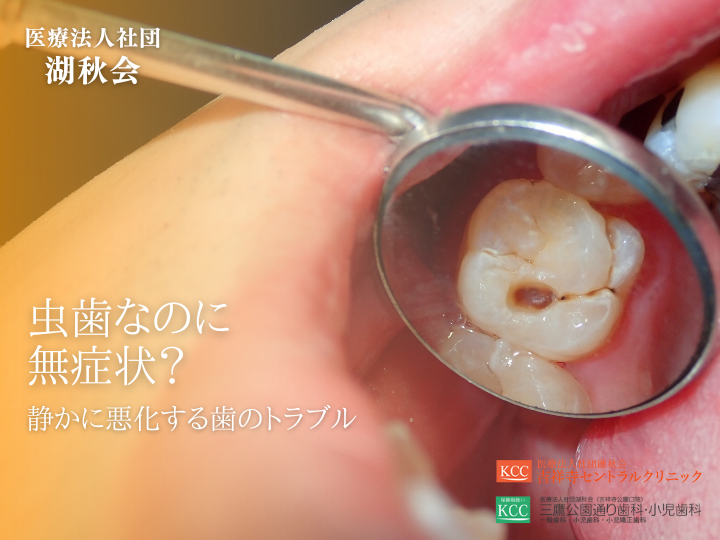 虫歯なのに無症状？静かに悪化する歯のトラブル