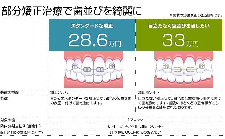 部分矯正治療で歯並びを綺麗に