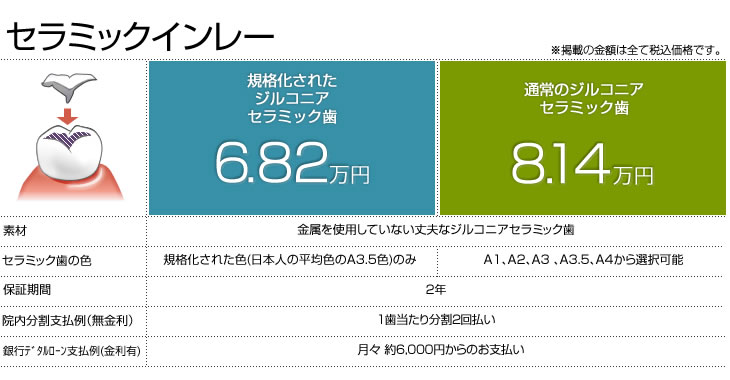 セラミックインレー