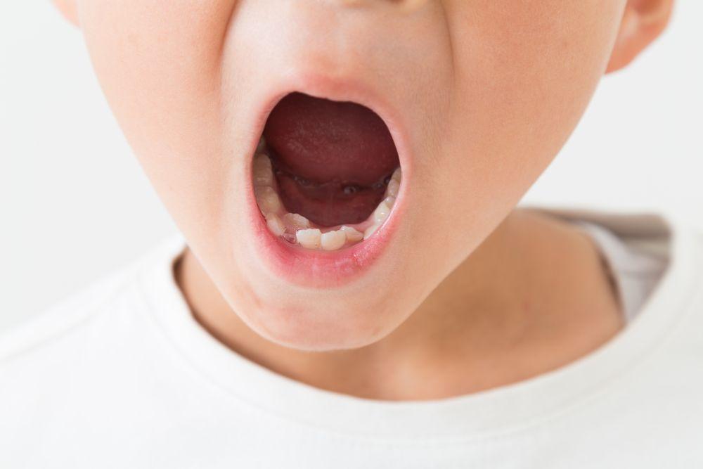 「6歳臼歯」は最初に生える永久歯のこと！虫歯から守る方法とは？