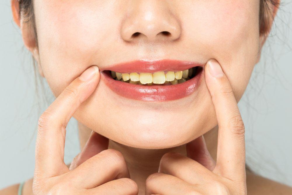 なぜ歯の黄ばみが出るの？原因や対処法、予防策などをわかりやすく説明