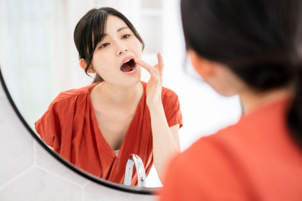 口内炎と口唇ヘルペスの違いとは？4種類ある口内炎の症状・原因・対処法を解説
