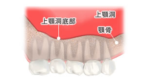 正常な歯のある上顎