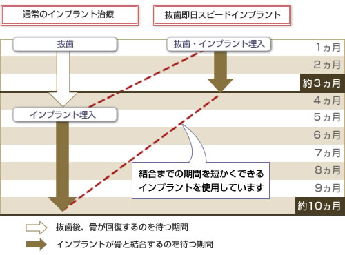 通常のインプラント治療と抜歯即日スピードインプラント治療の比較