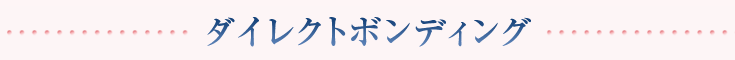 ダイレクトボンディング