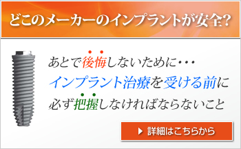 インプラント特集　インプラント治療を受ける前に必ず把握しなければならないこと