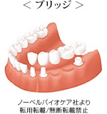 < ブリッジ >