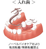< 入れ歯 >